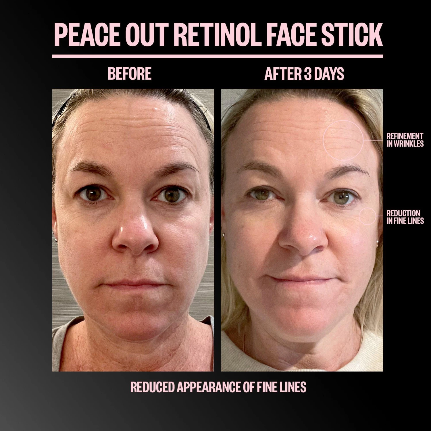 Retinol Face Stick 7 Retinol Face Stick - Image 5